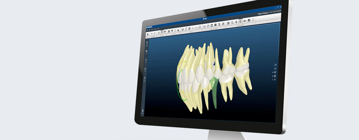 Insignia™: das digitale Behandlungssystem